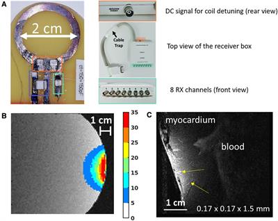 Remotely detuned receiver coil for high-resolution interventional cardiac magnetic resonance imaging